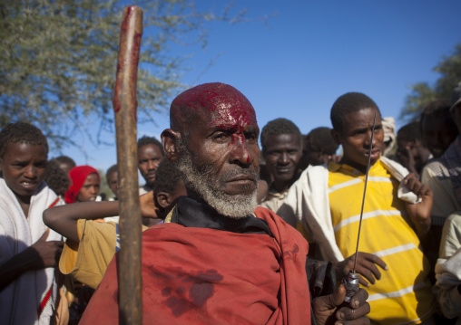 Abdicating Leader Of The Karrayyu Tribe With His Head Covered By Cow Blood Standing Proud Among His People During Gadaaa Ceremony, Metahara, Ethiopia