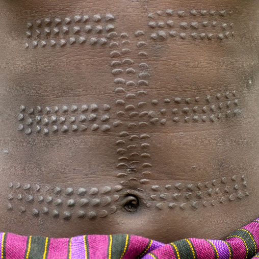 Detail Of Scarified Belly Of Mursi Woman Near Jinka Omo Valley Ethiopia