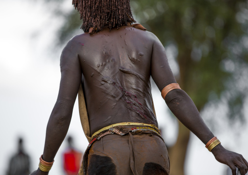 Bashada Tribe Woman With Whip Scars In Her Back During A Bull Jumping Ceremony, Dimeka, Omo Valley, Ethiopia