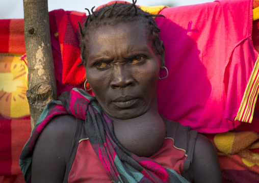 Majang Tribe Woman With Goitre , Kobown, Ethiopia