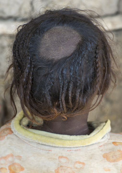 Afar Tribe Girl With Tonsure On The Head To Protect Her From The Bad Spririts, Afambo, Ethiopia