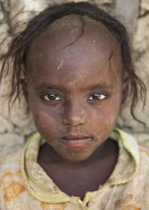 Afar Tribe Girl With Tonsure On The Head To Protect Her From The Bad Spririts, Afambo, Ethiopia