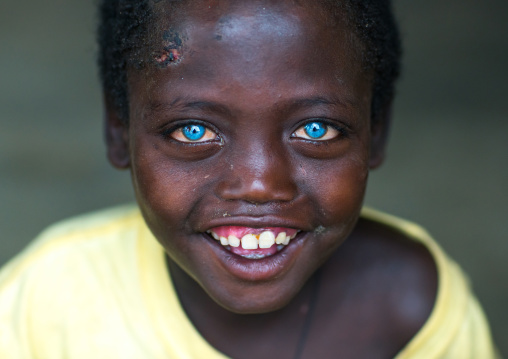 Smiling ethiopian boy called abushe with blue eyes suffering from waardenburg syndrome, Omo valley, Jinka, Ethiopia