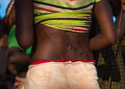 Hamer tribe woman back whipped during a bull jumping ceremony, Omo valley, Turmi, Ethiopia