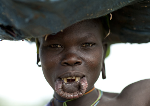 Surma Woman With A Stretched Lip, Turgit Village, Omo Valley, Ethiopia