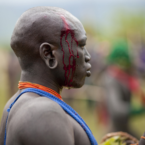 Man bleeding after he got hit during the donga stick fighting ritual in  Surma tribe, Tulgit,  Omo valley, Ethiopia