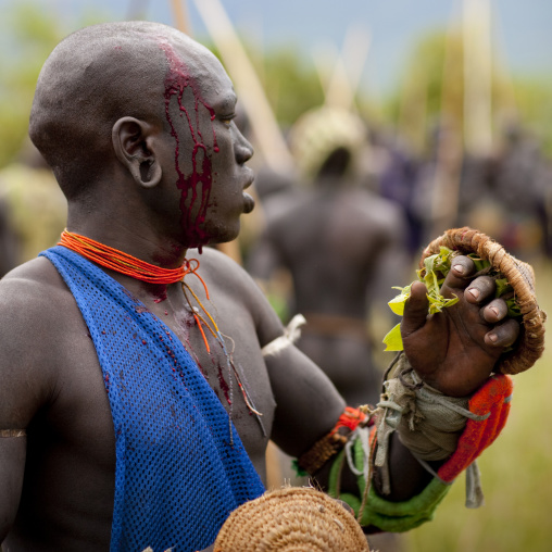 Man Bleeding After He Got Hit During The Donga Stick Fighting Ritual, Surma Tribe, Omo Valley, Ethiopia