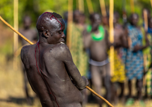 Suri tribe warrior bleeding during a donga stick fighting ritual, Omo valley, Kibish, Ethiopia
