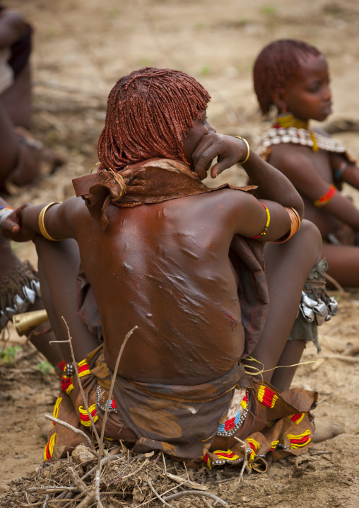Hamar Tribe Woman After Getting Her Back Whipped At A Bull Jumping Ceremony, Turmi, Omo Valley, Ethiopia
