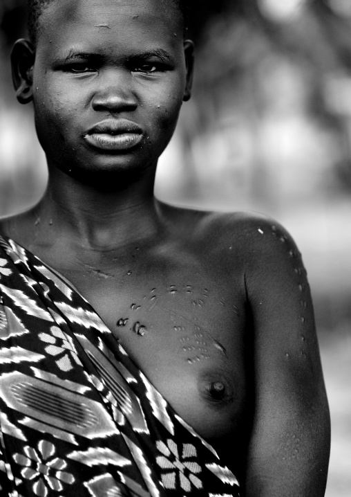 Bodi Tribe Woman With Scarified Body, Omo Valley, Ethiopia