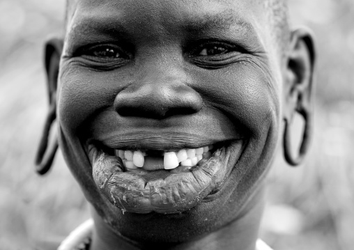Black And White Portrait Of A Surma Tribe Woman With Enlarged Lip And Ears And Toothy Smile, Omo Valley, Ethiopia