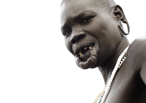 Portrait Of A Surma Tribe Woman With Enlarged Lip And Ears, Omo Valley, Ethiopia