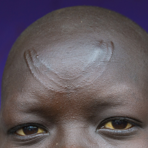Forehead scars of a Suri tribe girl, Kibish, Omo valley, Ethiopia