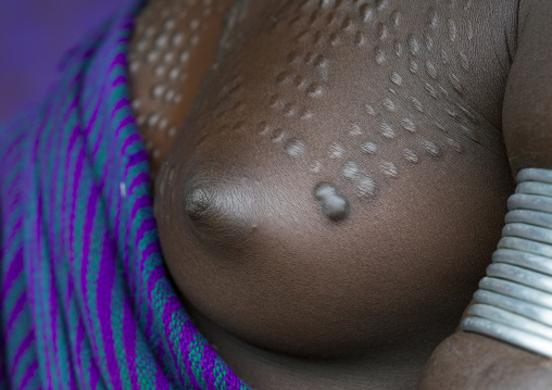 Details of the scarifications of a Suri tribe woman breast, Kibish, Omo valley, Ethiopia