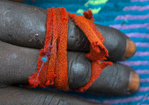 Fingers broken after a donga fight, Kibish, Omo valley, Ethiopia