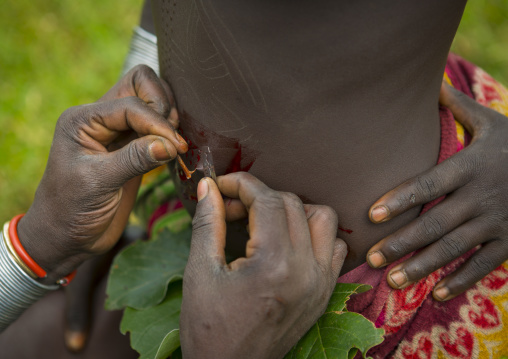 Detail of the belly of a Suri tribe woman during a scarification ceremony, Tulgit, Omo valley, Ethiopia