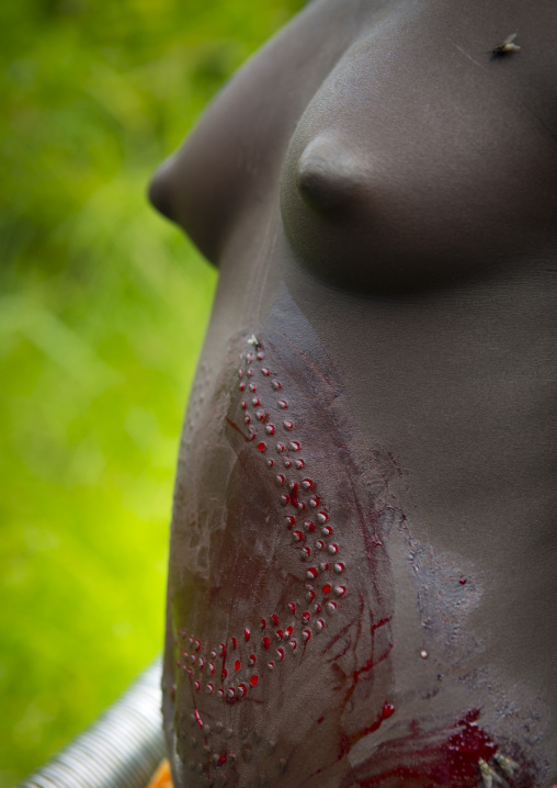 Detail of the pattern of scarifications on the bloody belly of a Suri tribe girl during a scarification ceremony, Tulgit, Omo valley, Ethiopia