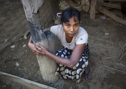 Rohingya Woman Showing The Pillar Of Her House Burnt By 969 Extremists Buddhists, Thandwe, Myanmar