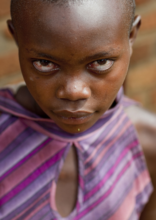 Rwandan girl crying, Kigali Province, Kigali, Rwanda