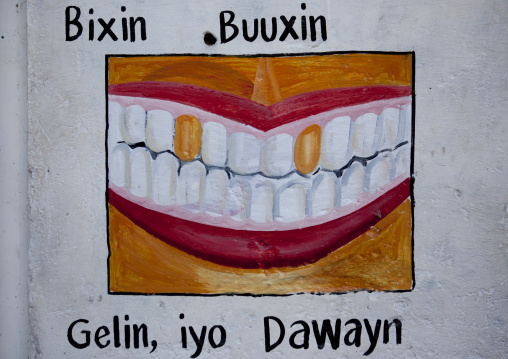 A Painted Sign Advertising For A Dentist Depicting A Mouth With Some Golden Teeth, Somaliland