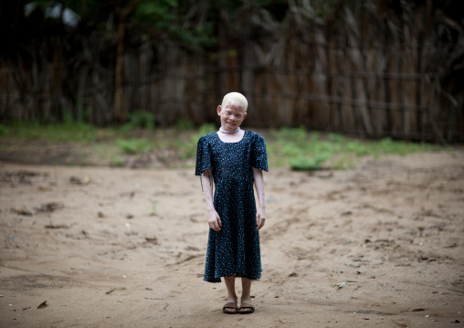 Zamda, Albino girl in mikindani, Tanzania