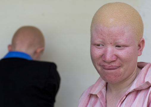 Tanzania, East Africa, Dar es Salaam, jenipher stanford a teen with albinism at under the same sun house