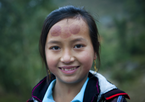 Black hmong girl with tattoos on the forehead, Sapa, Vietnam