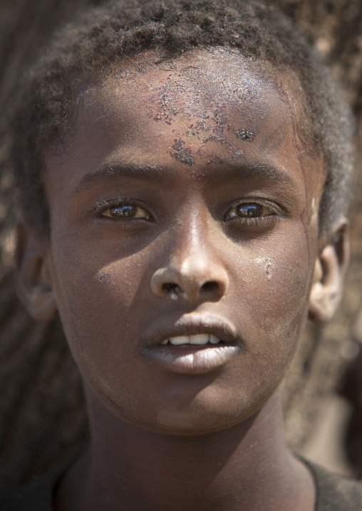 Portrait Of A Karrayyu Tribe Kid With Cow Blood On His Face, Gadaaa Ceremony, Metahara, Ethiopia