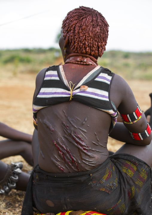 Bashada Tribe Woman Whipped During A Bull Jumping Ceremony, Dimeka, Omo Valley, Ethiopia